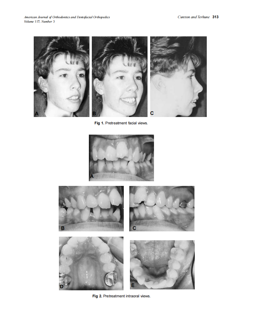 2000_117_3_312_319_Cureton.pdf 第2页