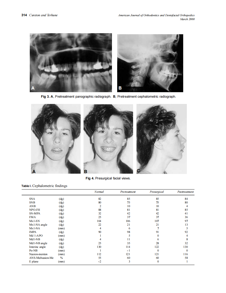2000_117_3_312_319_Cureton.pdf 第3页