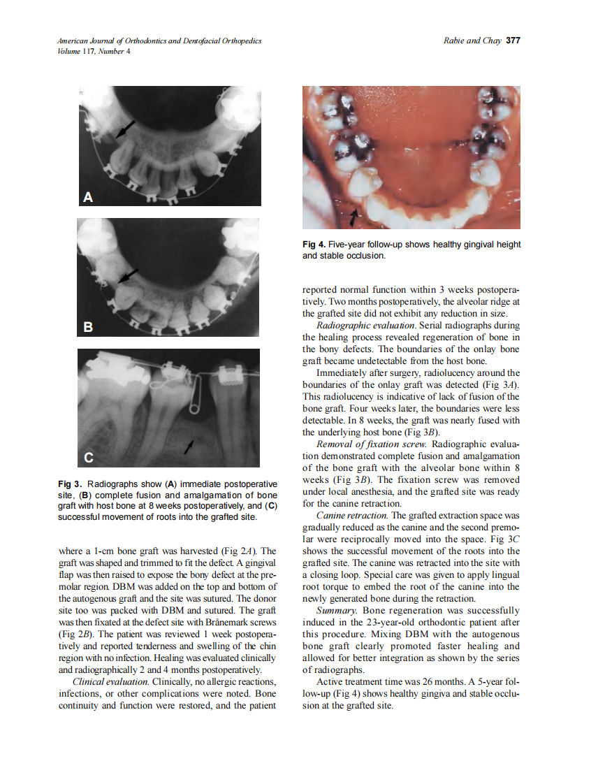 2000_117_4_375_383_Rabie.pdf 第3页