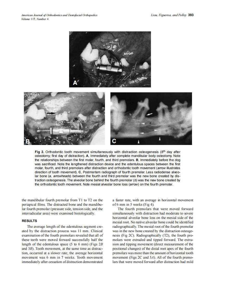 2000_117_4_391_398_Liou.pdf 第3页