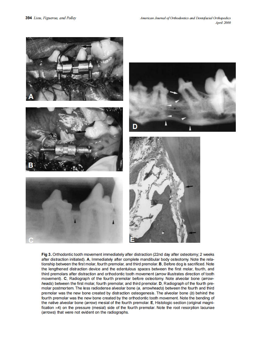 2000_117_4_391_398_Liou.pdf 第4页