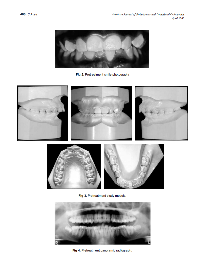 2000_117_4_459_464_Schach.pdf 第2页