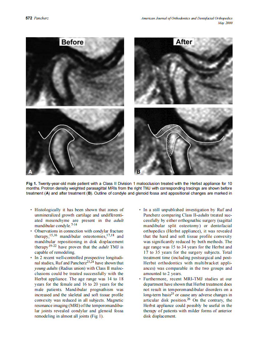 2000_117_5_571_574_Pancherz.pdf 第2页