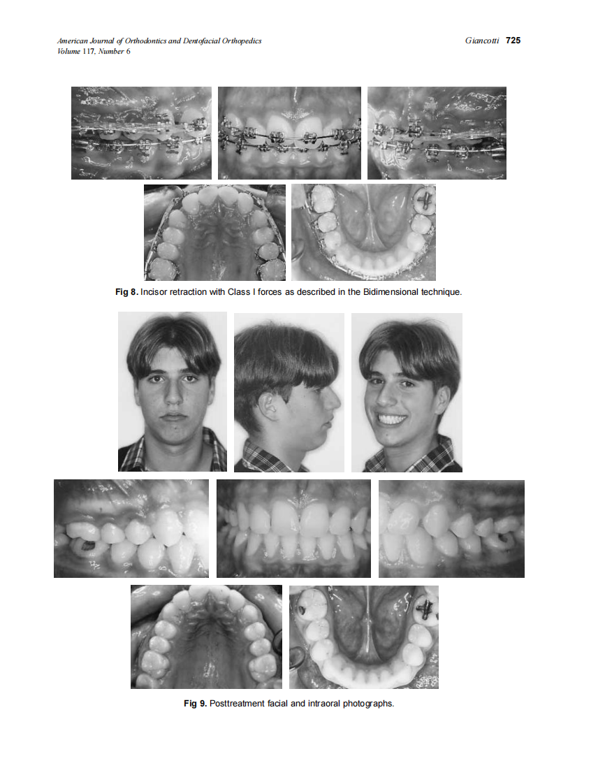 2000_117_6_721_727_Giancotti.pdf 第5页