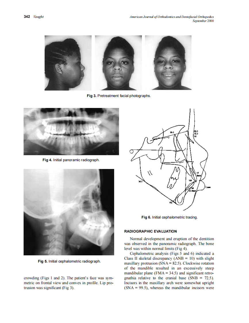 2000_118_3_341_346_Vaught.pdf 第2页
