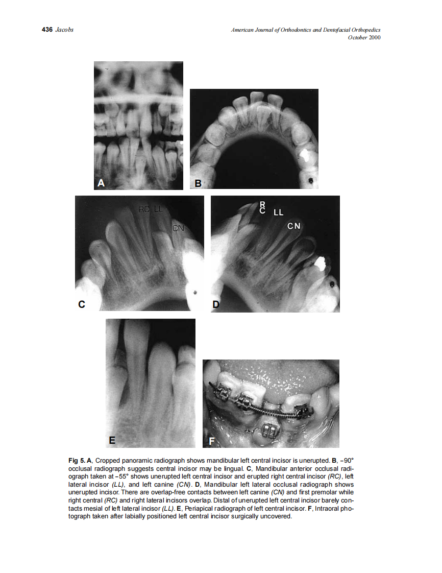 2000_118_4_432_438_Jacobs.pdf 第5页