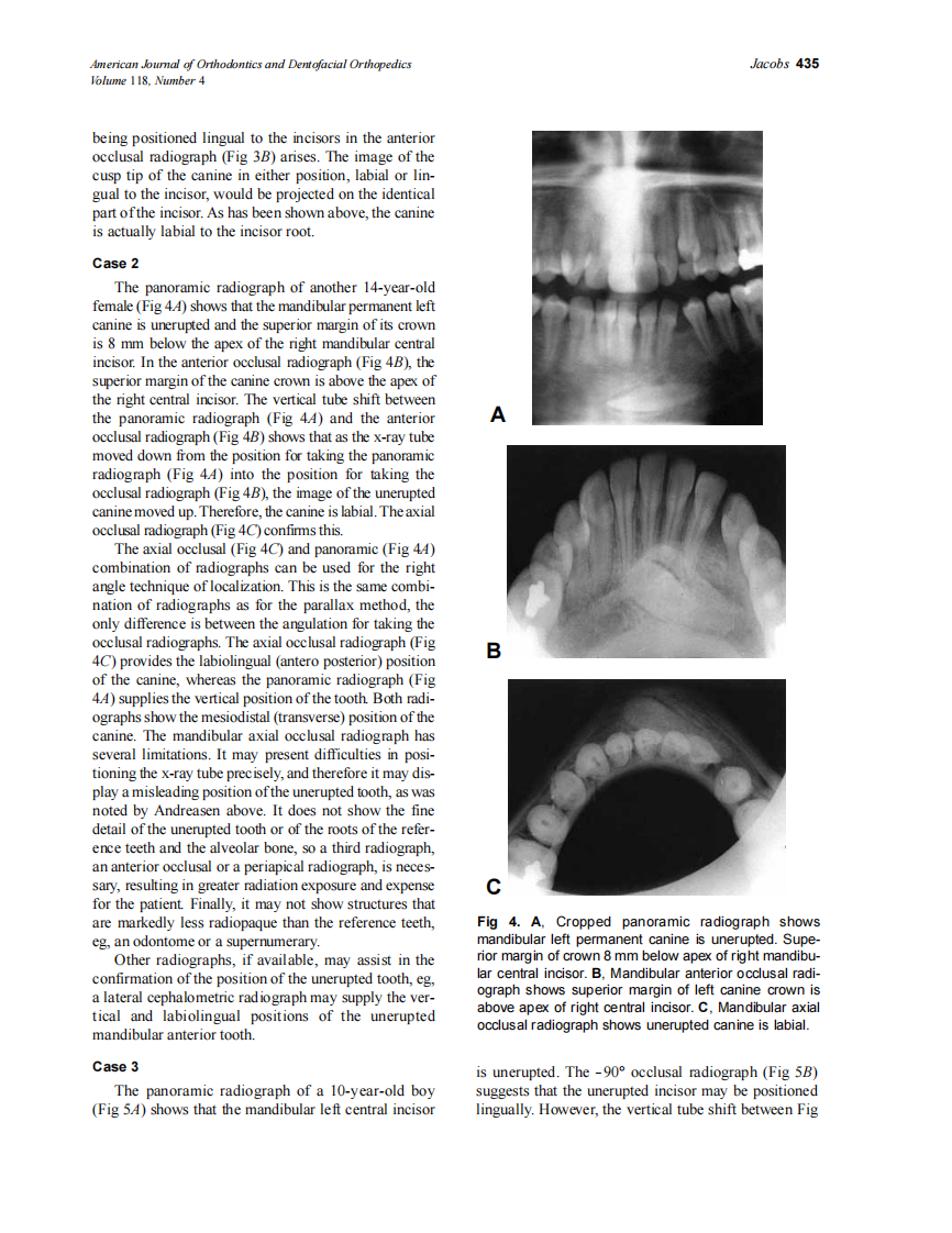 2000_118_4_432_438_Jacobs.pdf 第4页