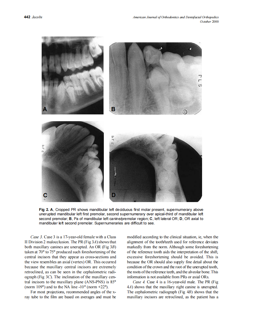 2000_118_4_439_447_Jacobs.pdf 第4页