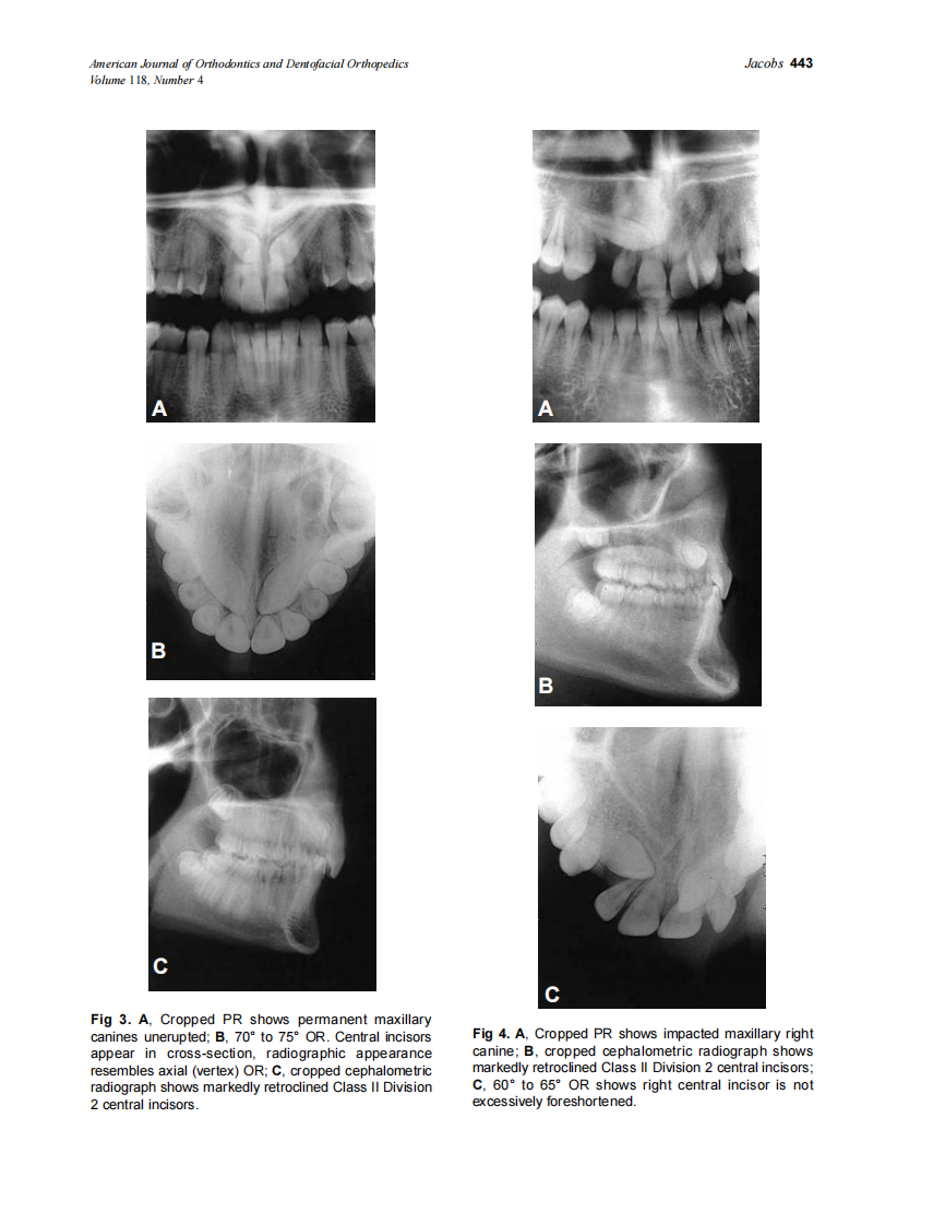 2000_118_4_439_447_Jacobs.pdf 第5页