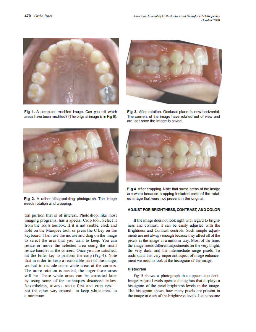 2000_118_4_469_475_Halazonetis.pdf 第2页