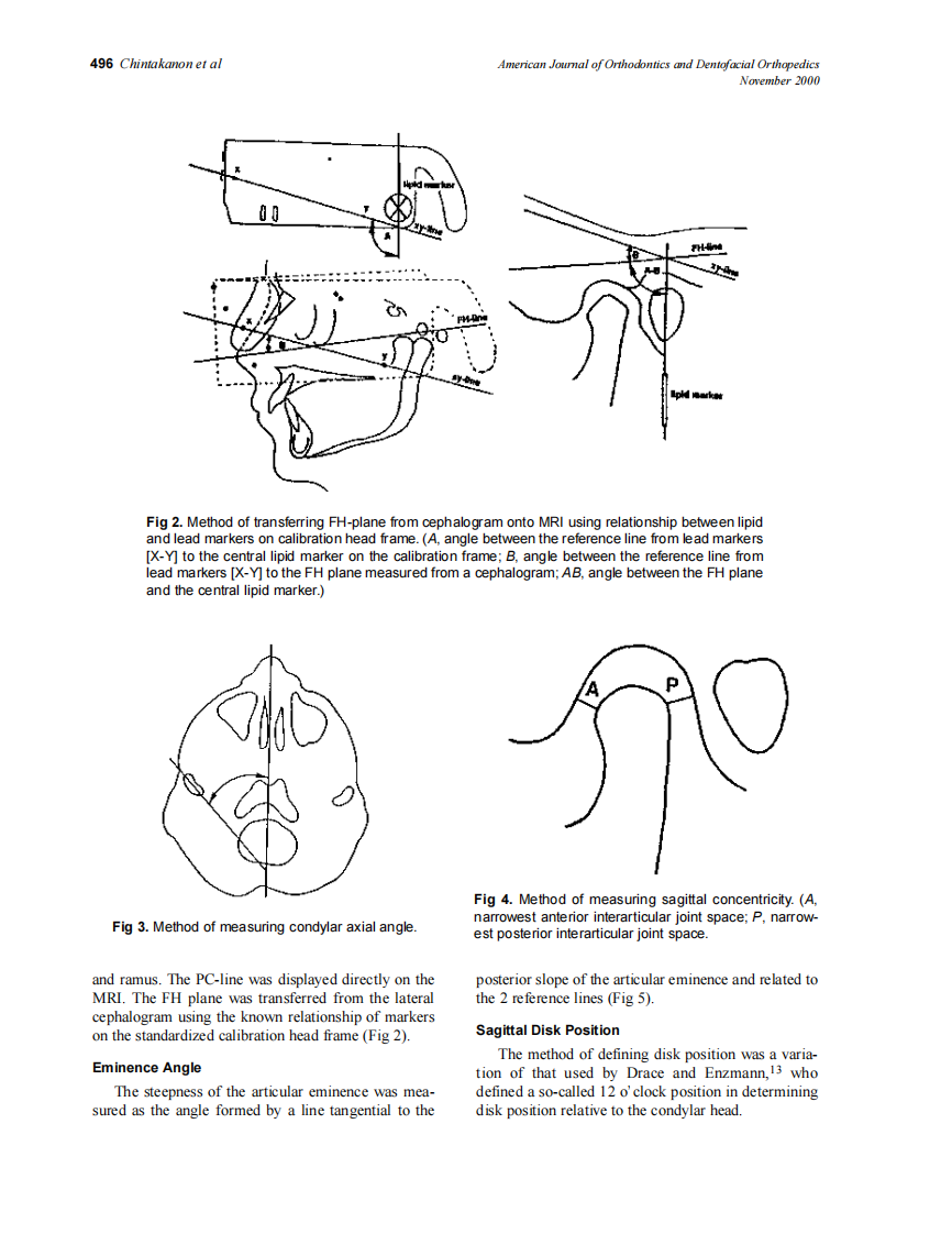 2000_118_5_494_504_Chintakanon.pdf 第3页