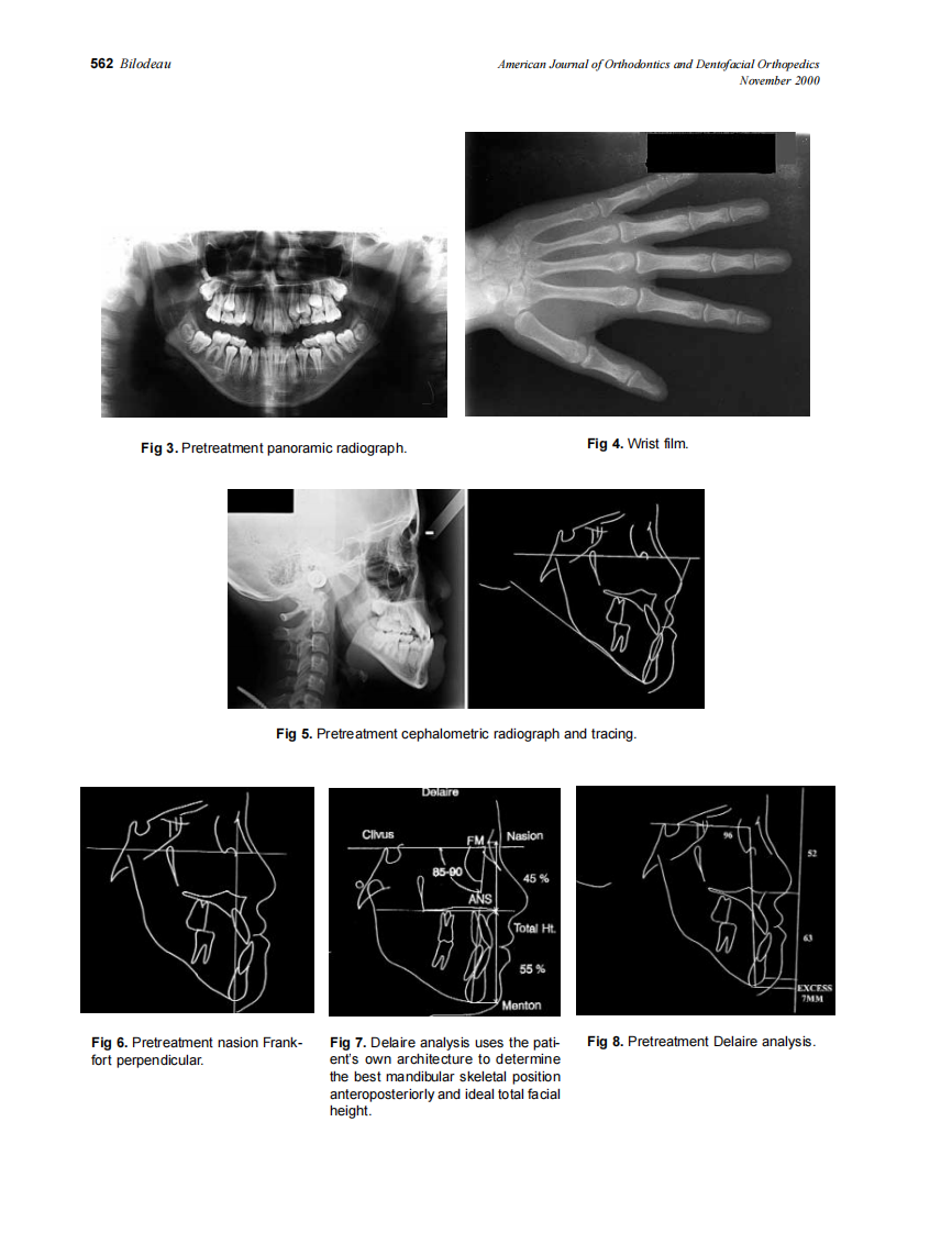 2000_118_5_560_565_Bilodeau.pdf 第3页