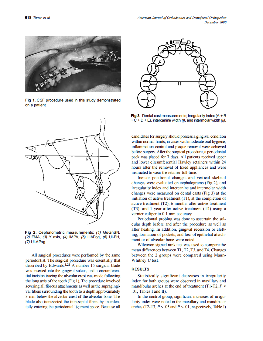 2000_118_6_617_623_Taner.pdf 第2页
