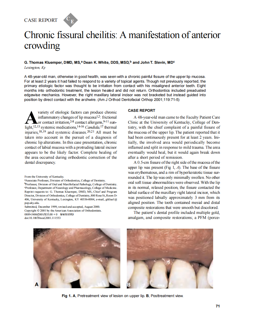 2001_119_1_71_75_Kluemper.pdf 第1页