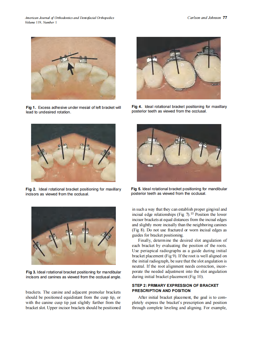 2001_119_1_76_80_Carlson.pdf 第2页