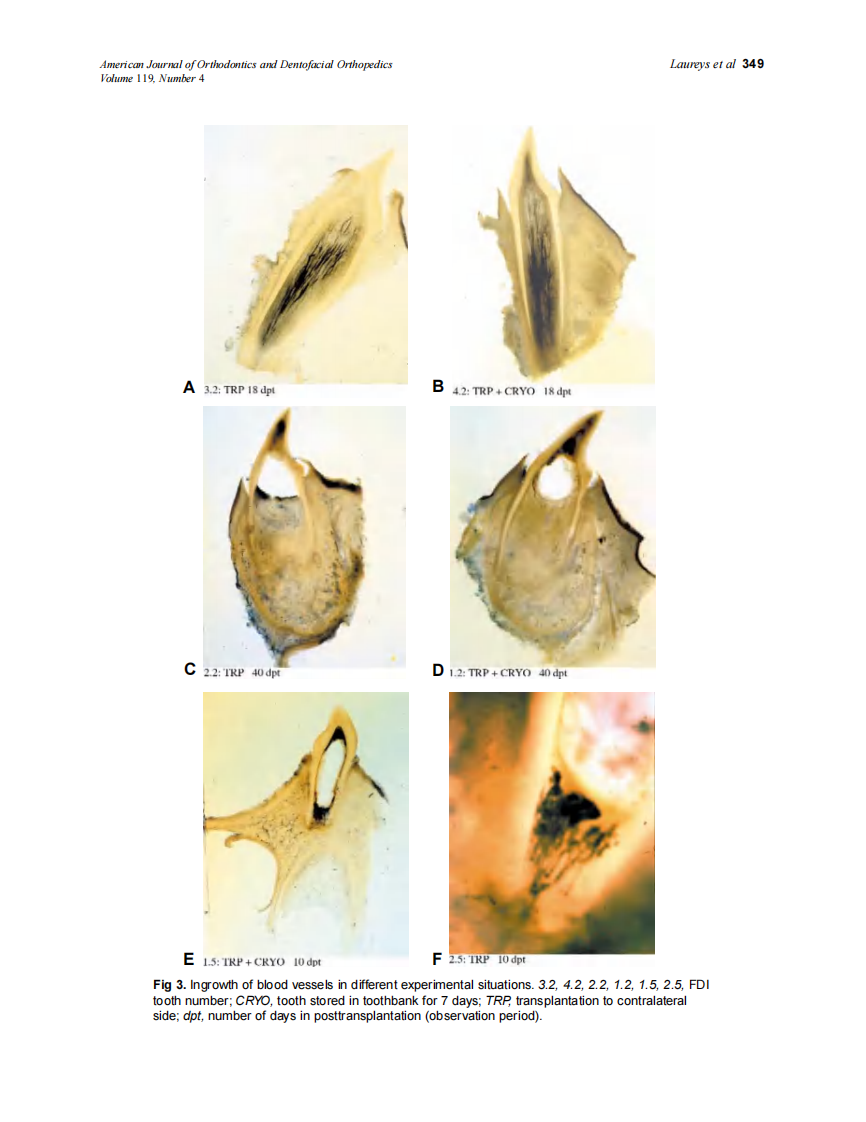 2001_119_4_346_352_Laureys.pdf 第4页