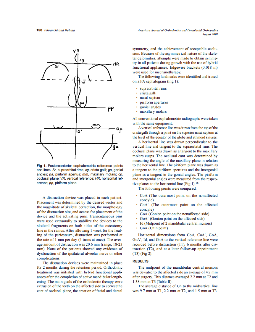 2001_120_2_149_153_Tehranchi.pdf 第2页
