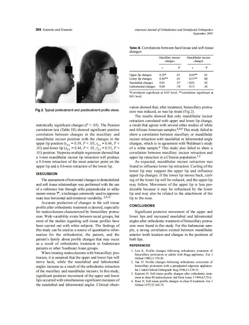2001_120_3_304_307_Kusnoto.pdf 第3页