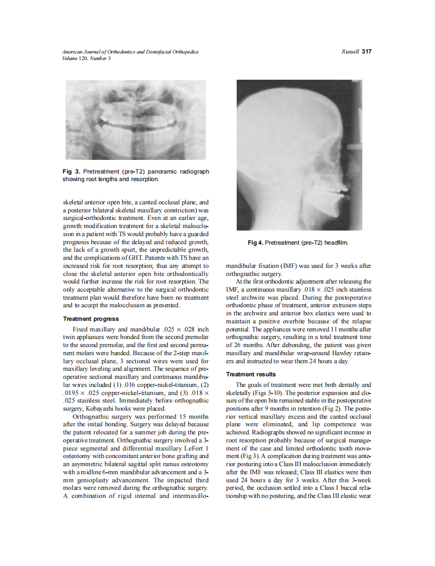 2001_120_3_314_322_Russell.pdf 第4页