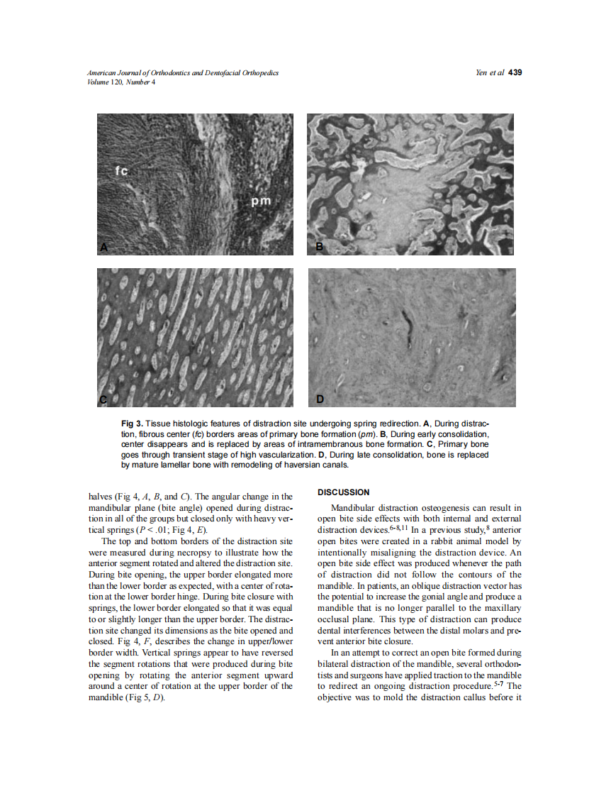 2001_120_4_435_442_Yen.pdf 第5页