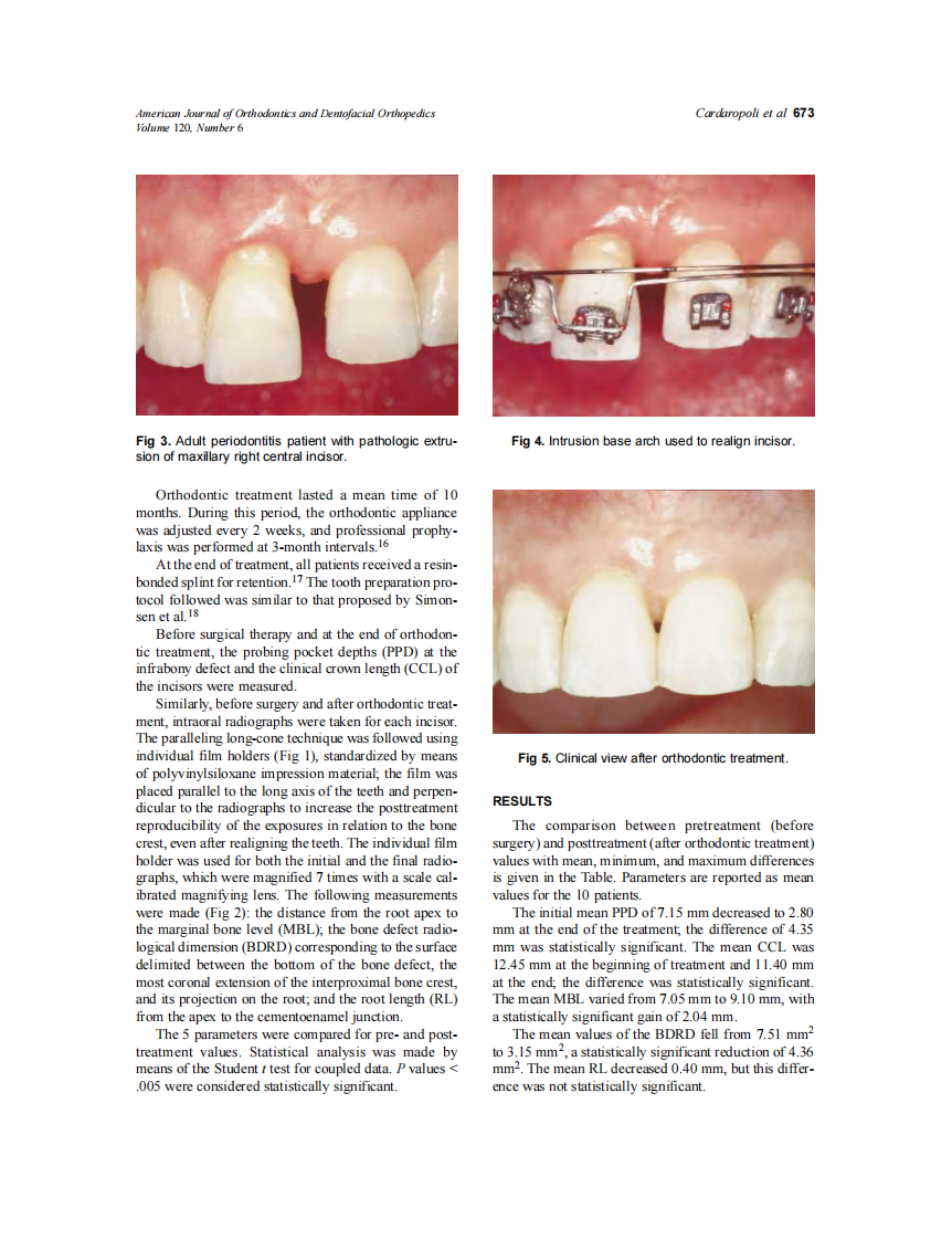 2001_120_6_671_675_Cardaropoli.pdf 第3页