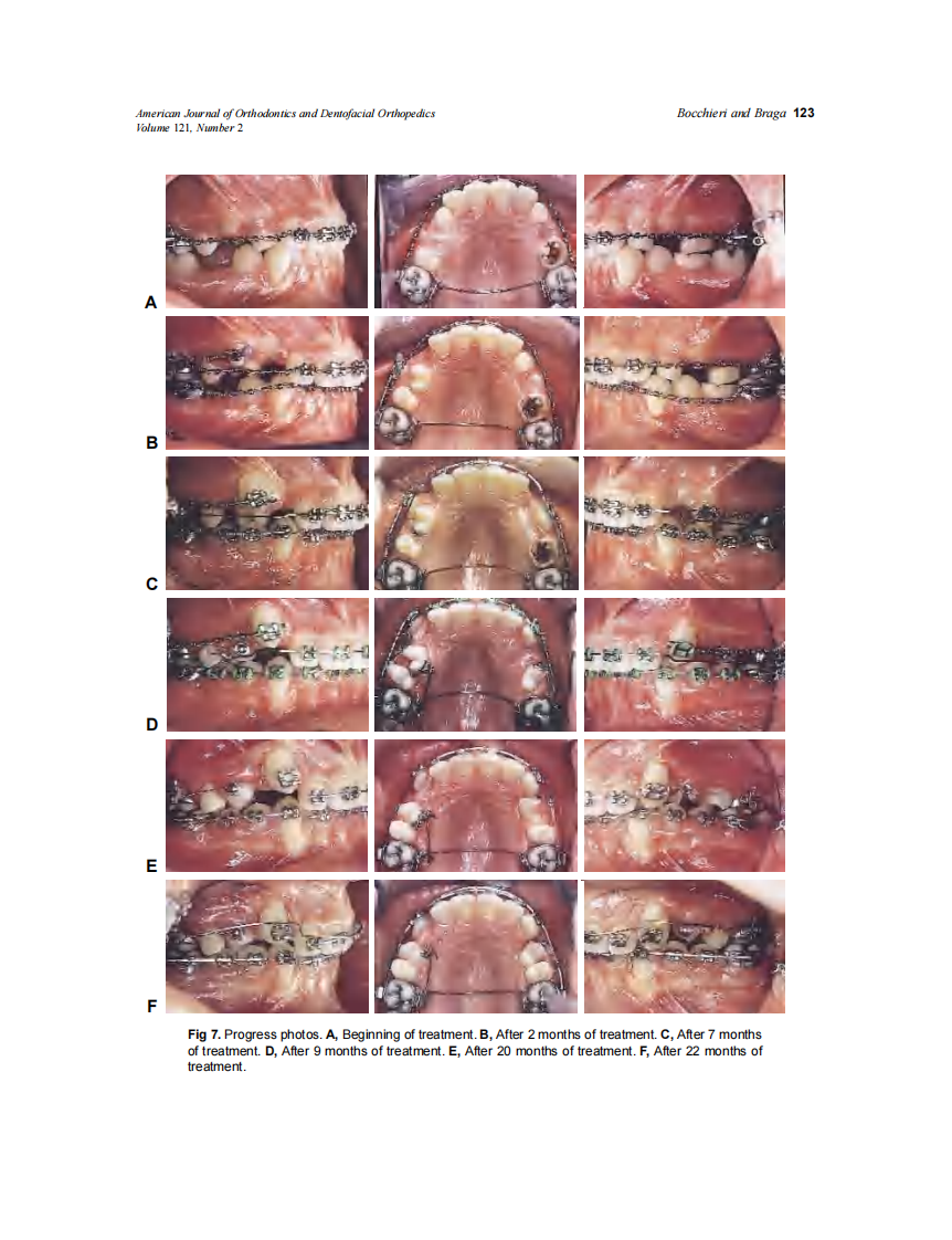 2002_121_2_120_128_Bocchieri.pdf 第4页