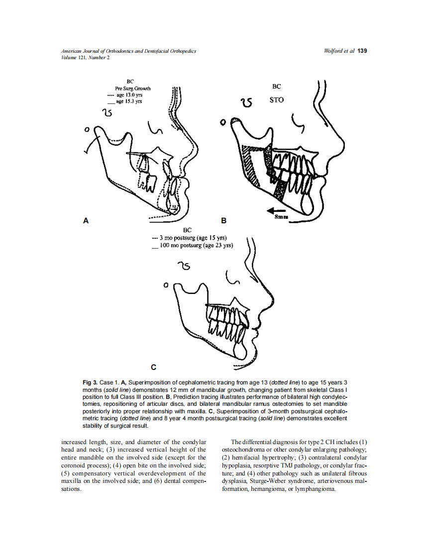 2002_121_2_136_151_Wolford.pdf 第4页