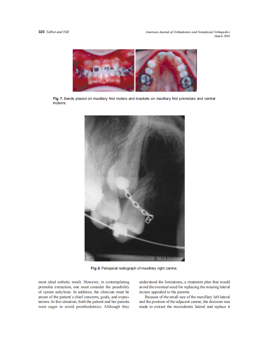 2002_121_3_316_323_Talbot.pdf 第5页