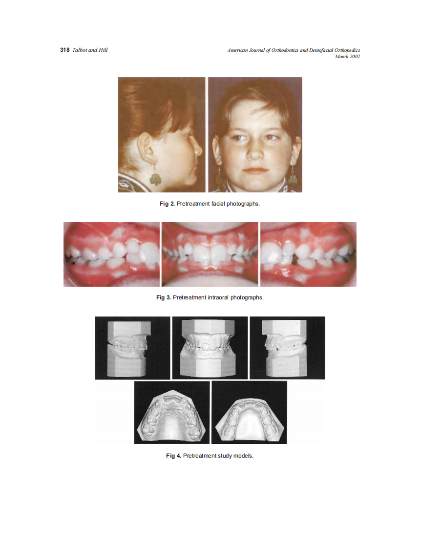 2002_121_3_316_323_Talbot.pdf 第3页