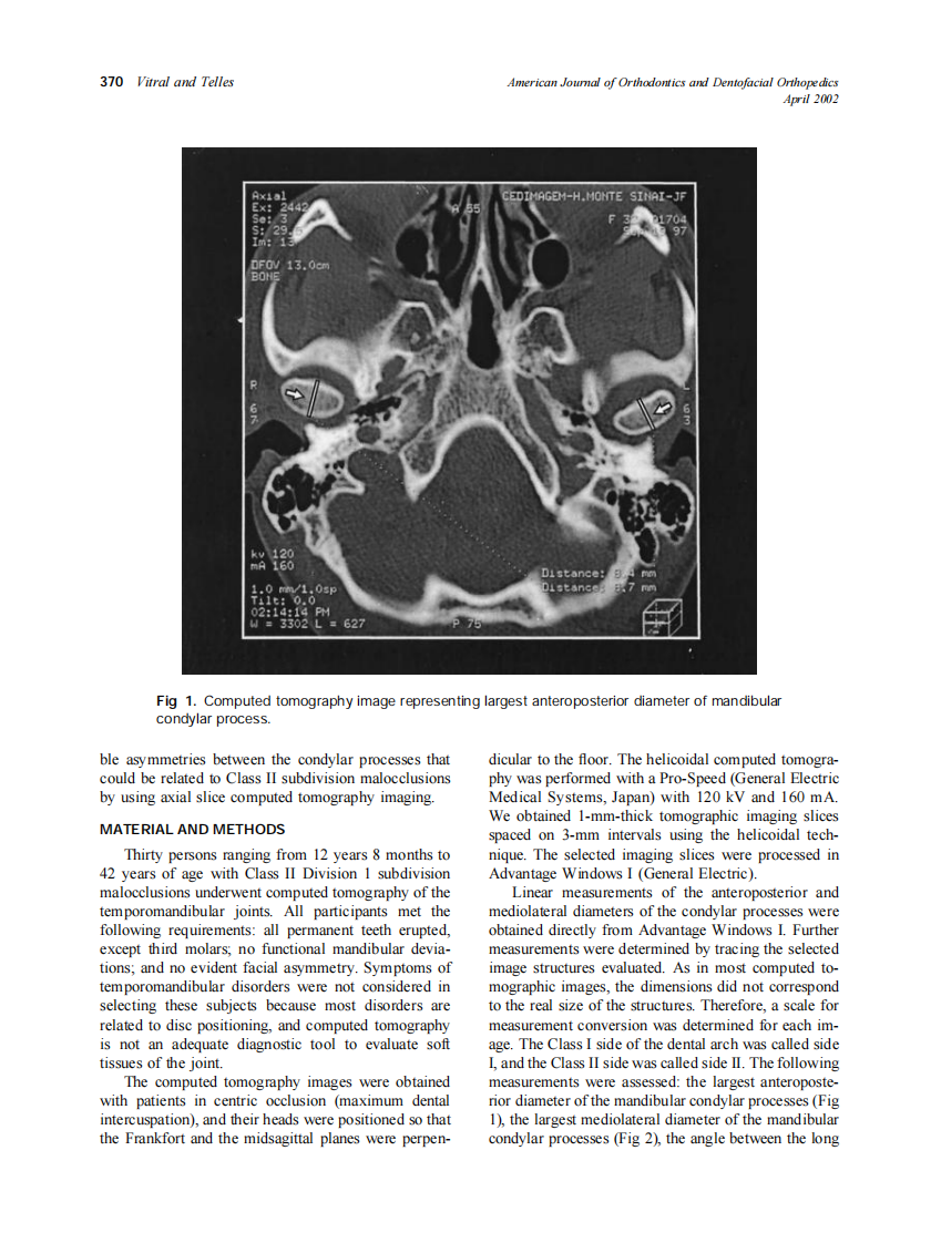 2002_121_4_369_375_Vitral.pdf 第2页