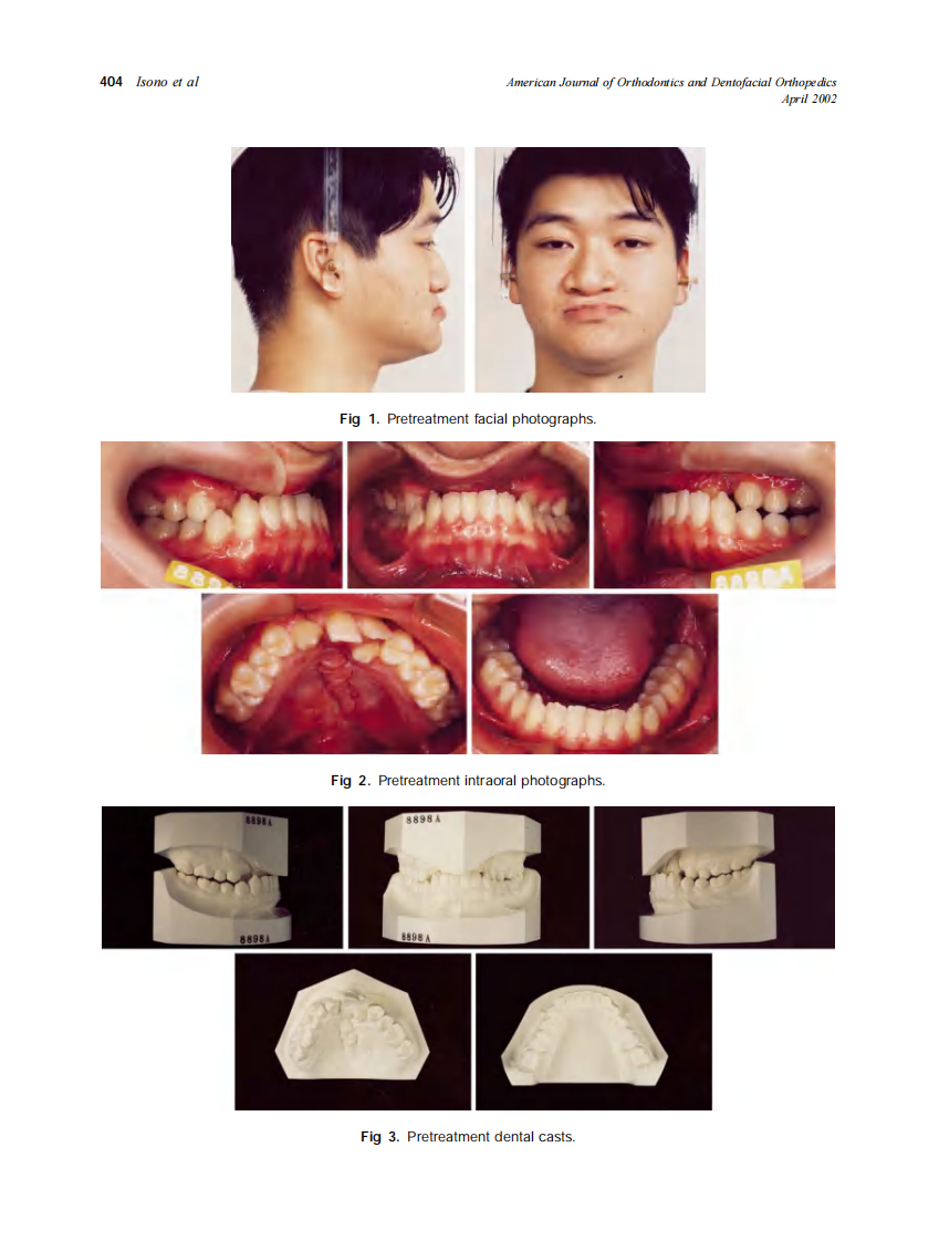 2002_121_4_403_410_Isono.pdf 第2页