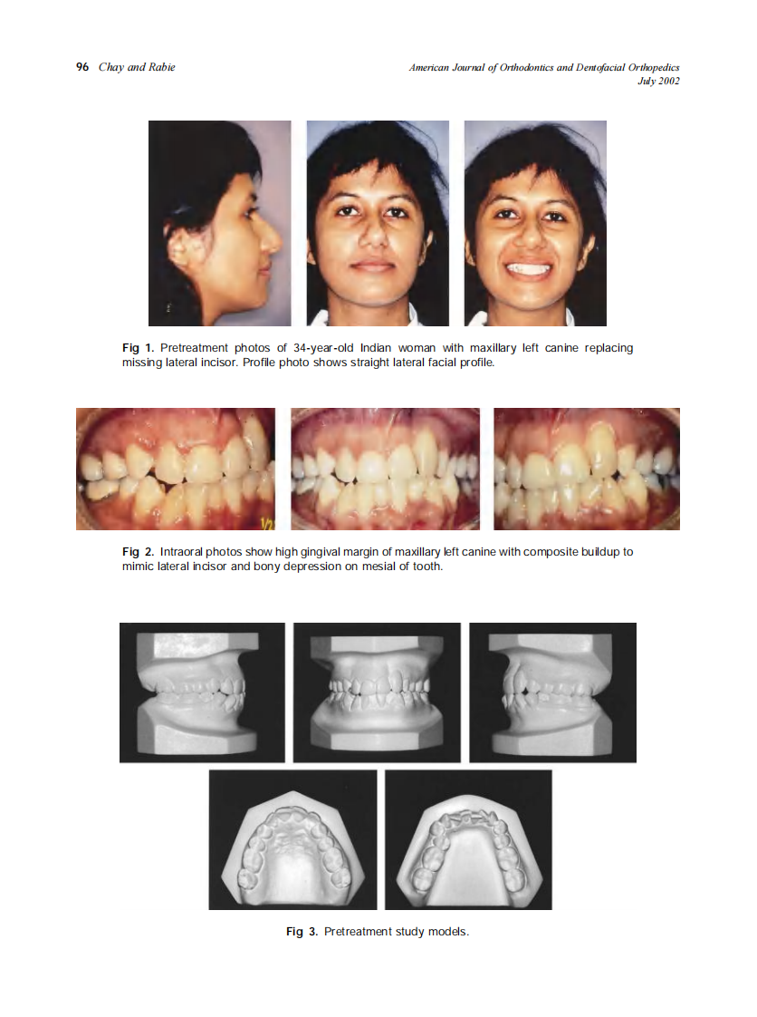 2002_122_1_95_102_Chay.pdf 第2页