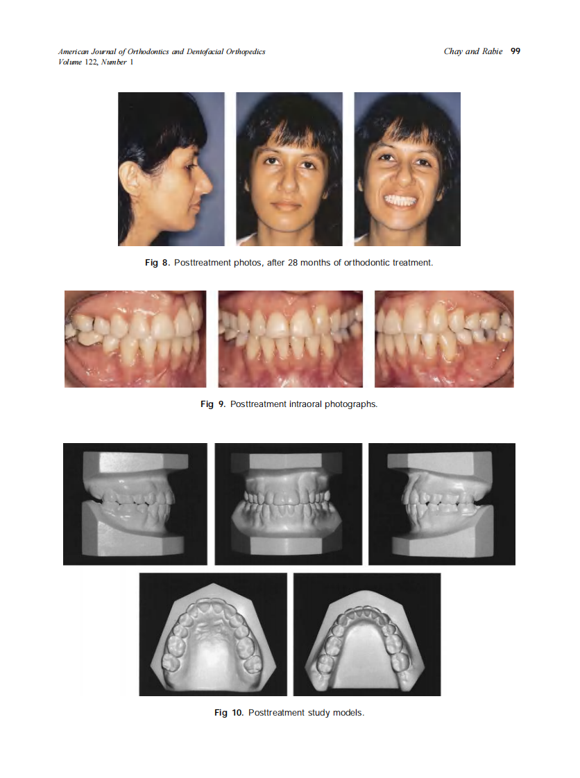 2002_122_1_95_102_Chay.pdf 第5页