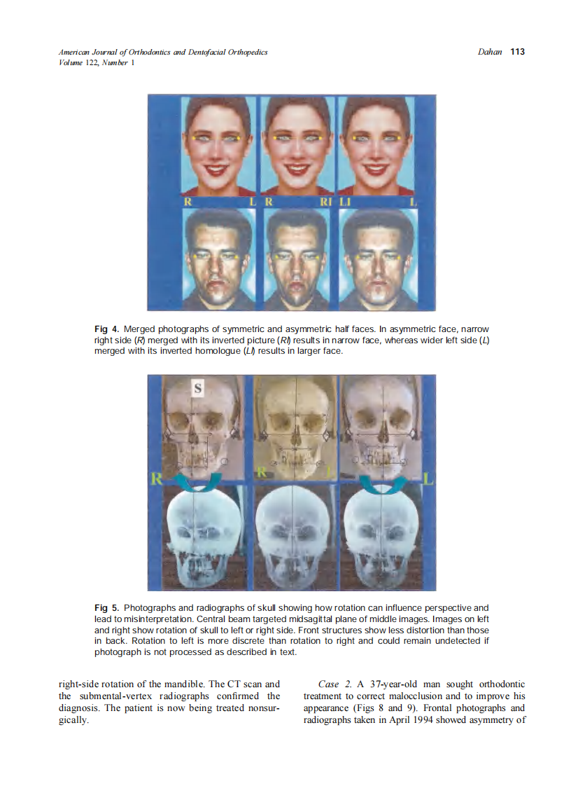 2002_122_1_110_116_Dahan.pdf 第4页