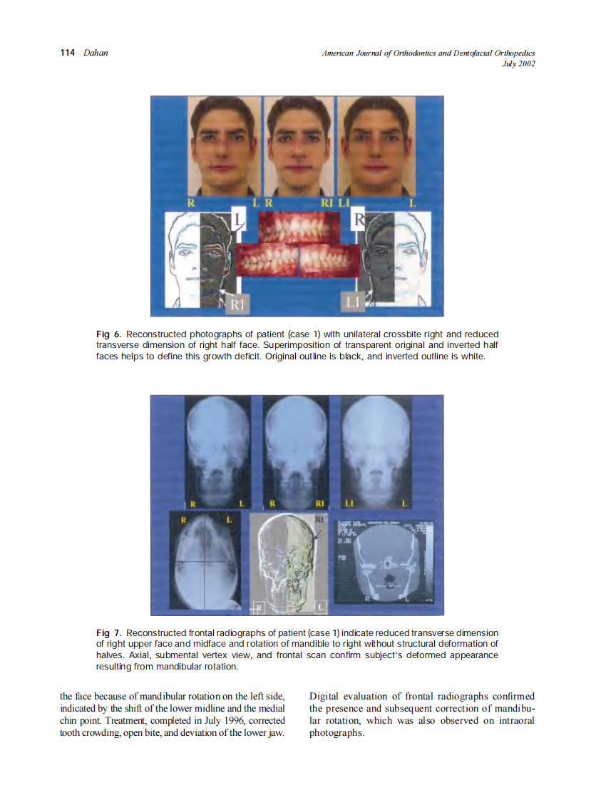 2002_122_1_110_116_Dahan.pdf 第5页