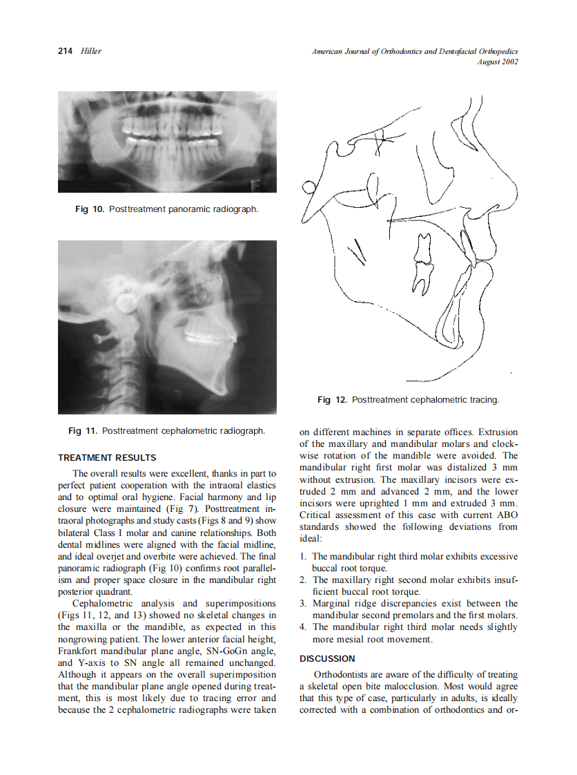 2002_122_2_210_216_Hiller.pdf 第5页