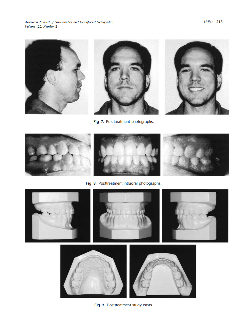2002_122_2_210_216_Hiller.pdf 第4页