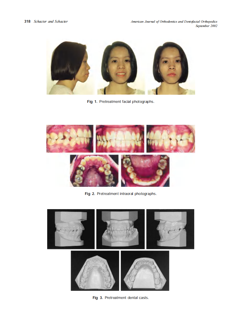 2002_122_3_317_322_Schacter.pdf 第2页