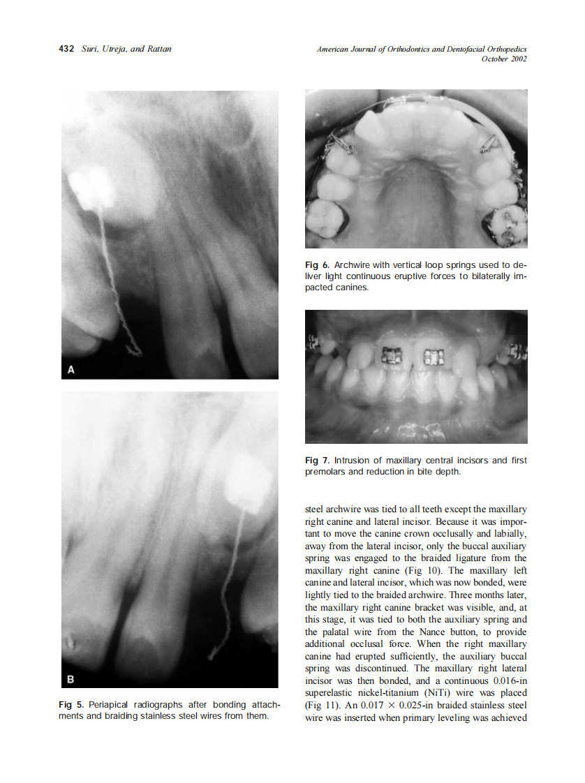 2002_122_4_429_437_Suri.pdf 第4页