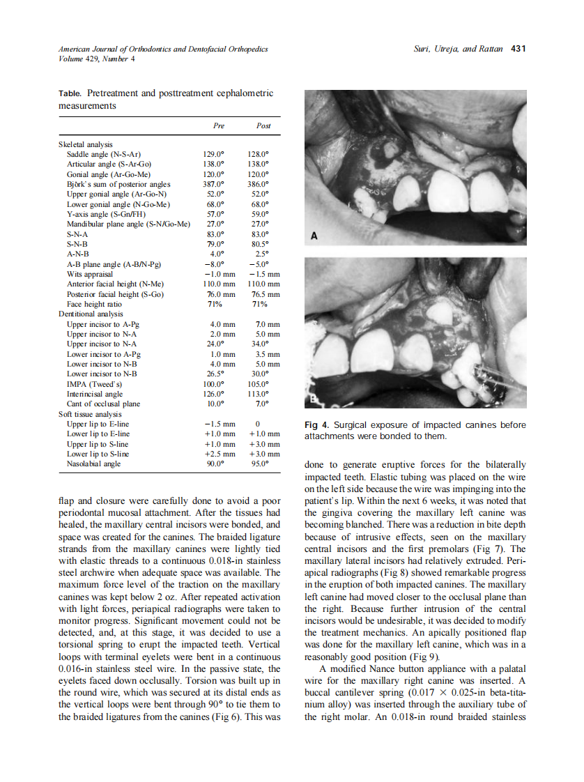 2002_122_4_429_437_Suri.pdf 第3页