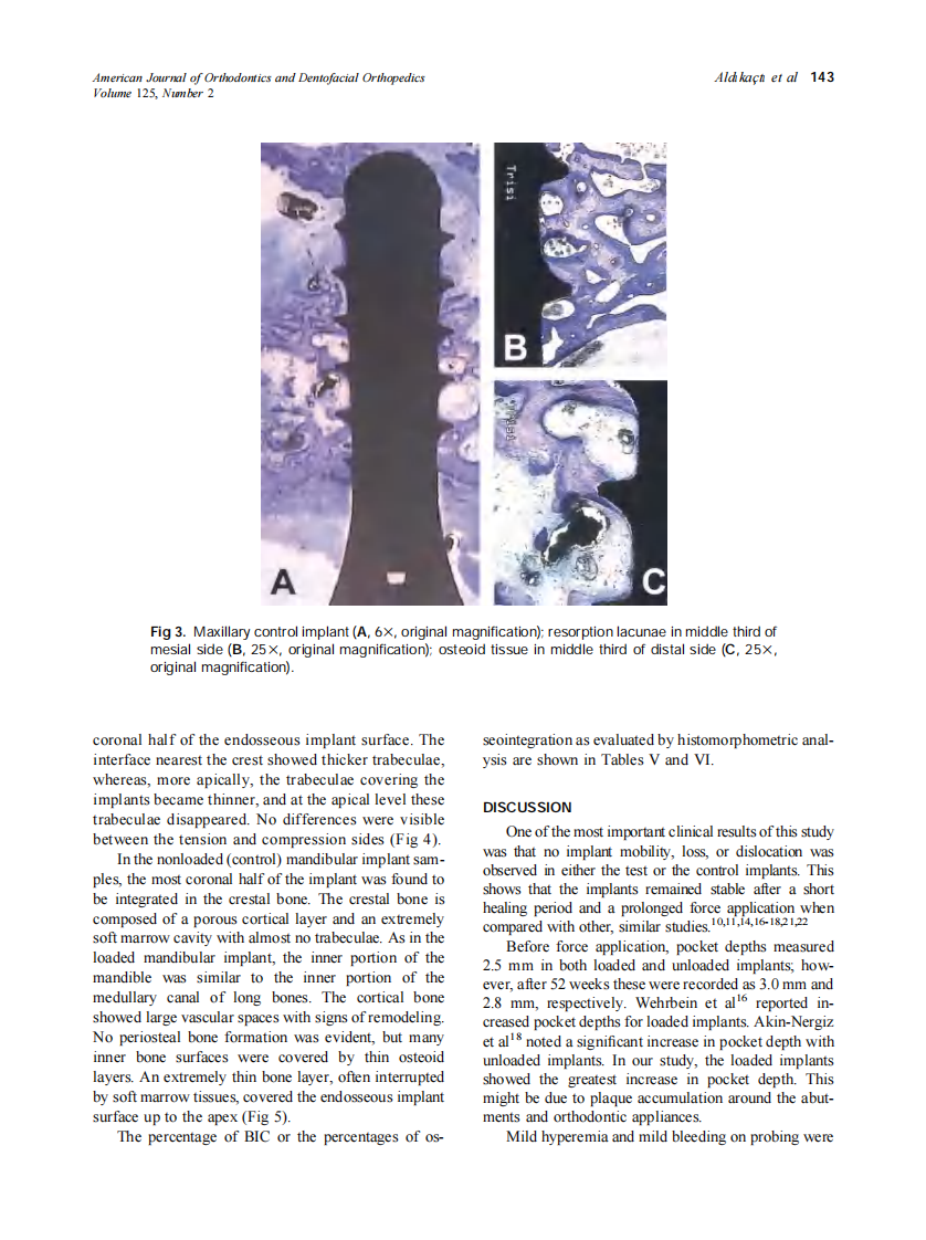 2004_125_2_139_147_Aldikacti.pdf 第5页