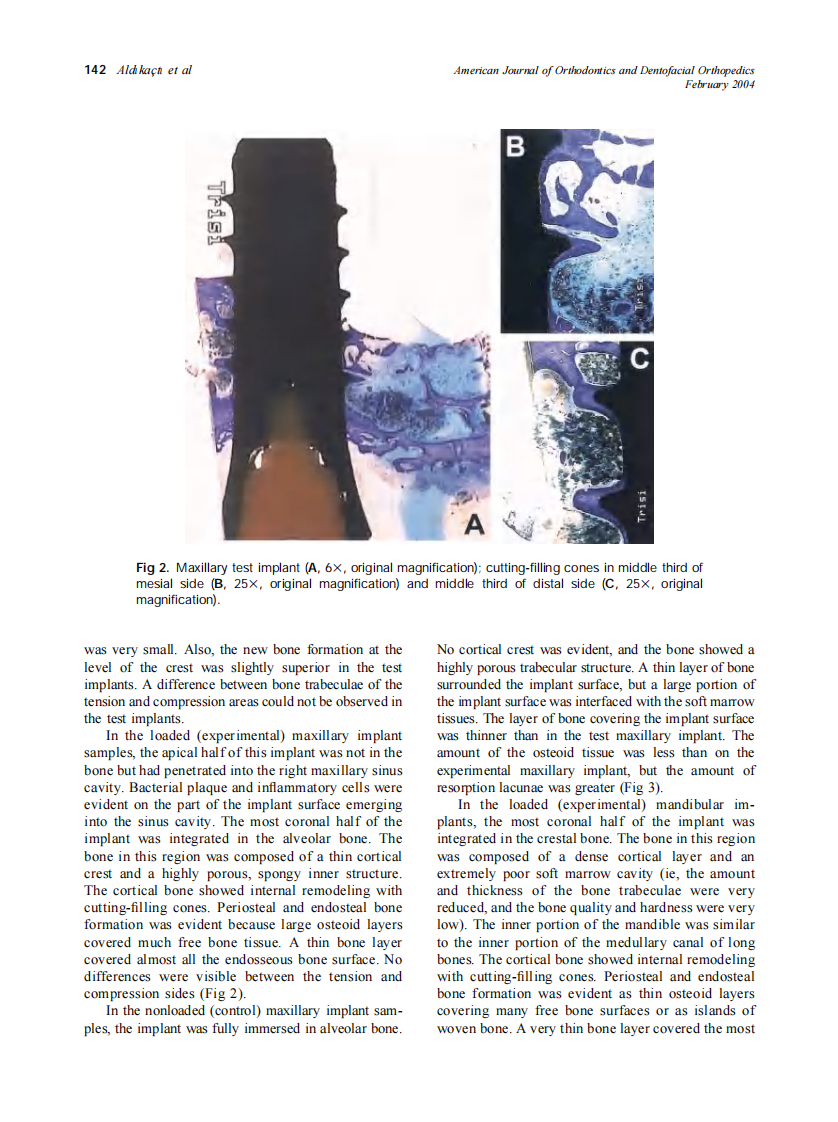 2004_125_2_139_147_Aldikacti.pdf 第4页