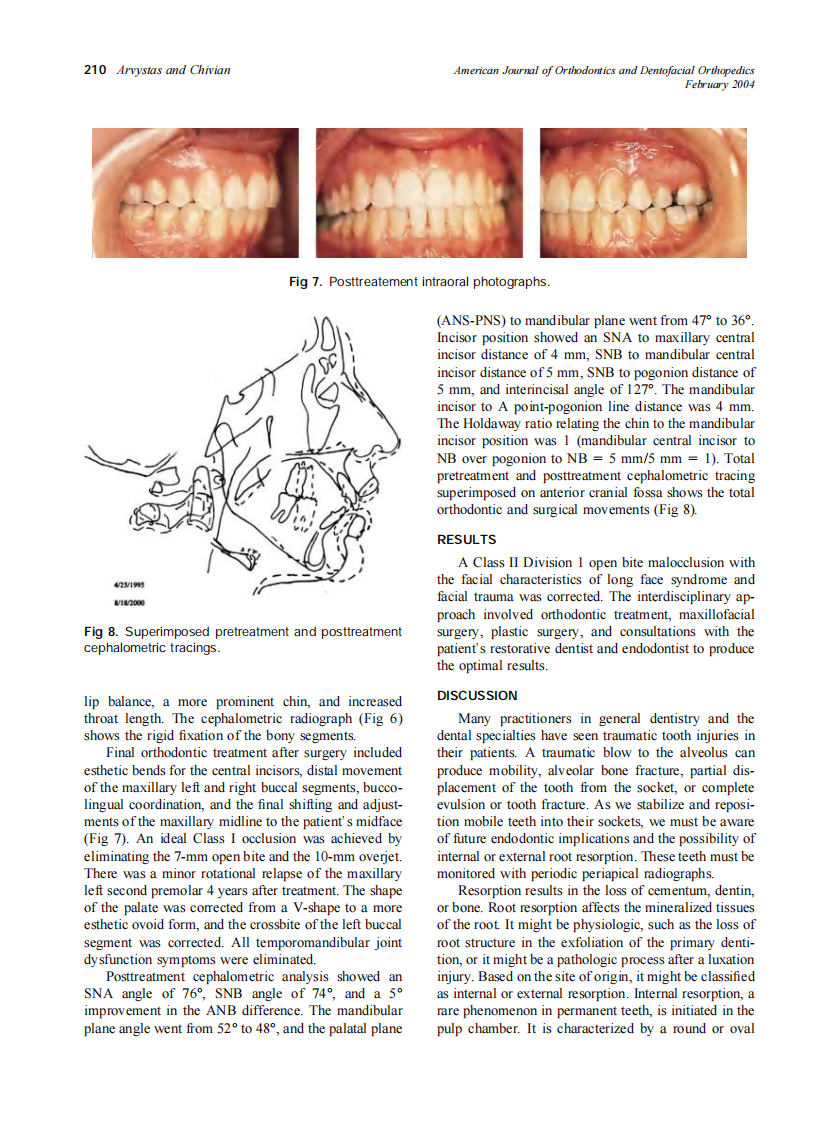2004_125_2_206_212_Arvystas.pdf 第5页