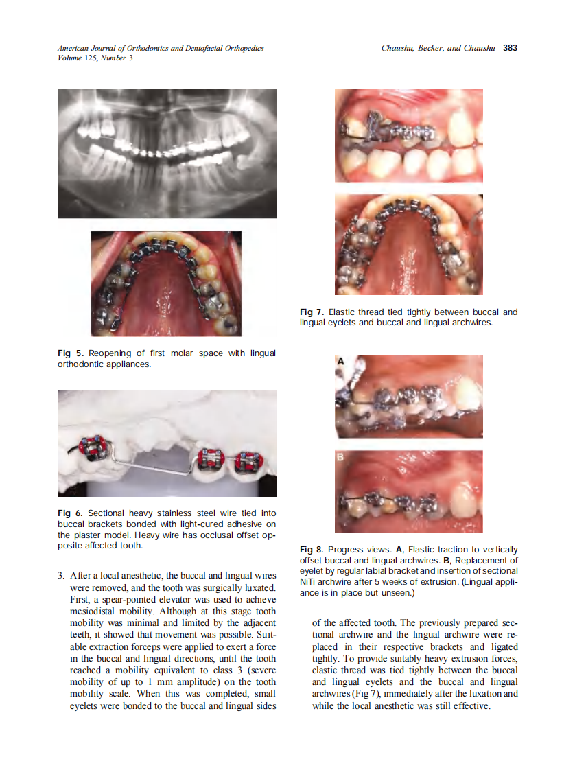 2004_125_3_379_387_Chaushu.pdf 第5页