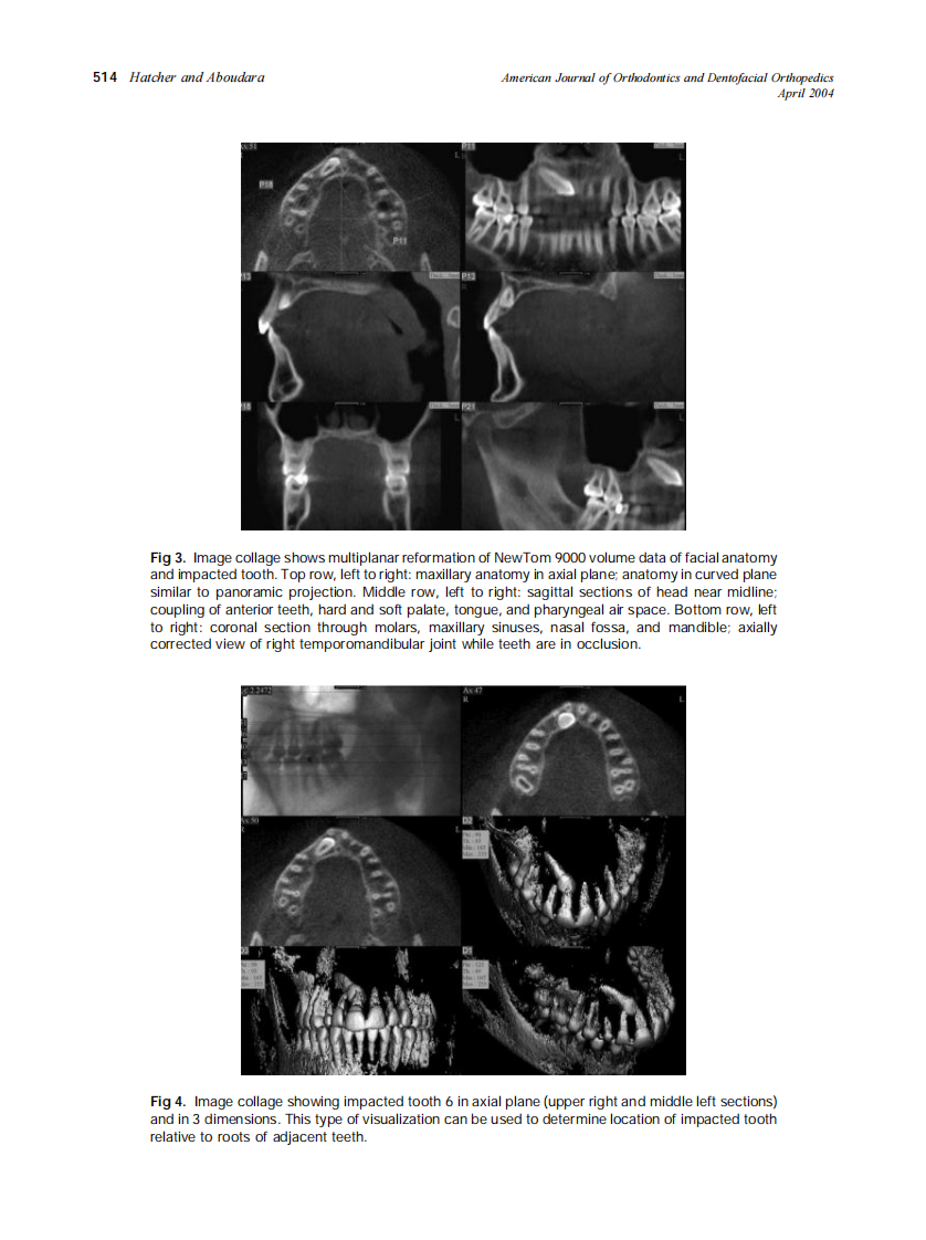 2004_125_4_512_515_Hatcher.pdf 第3页