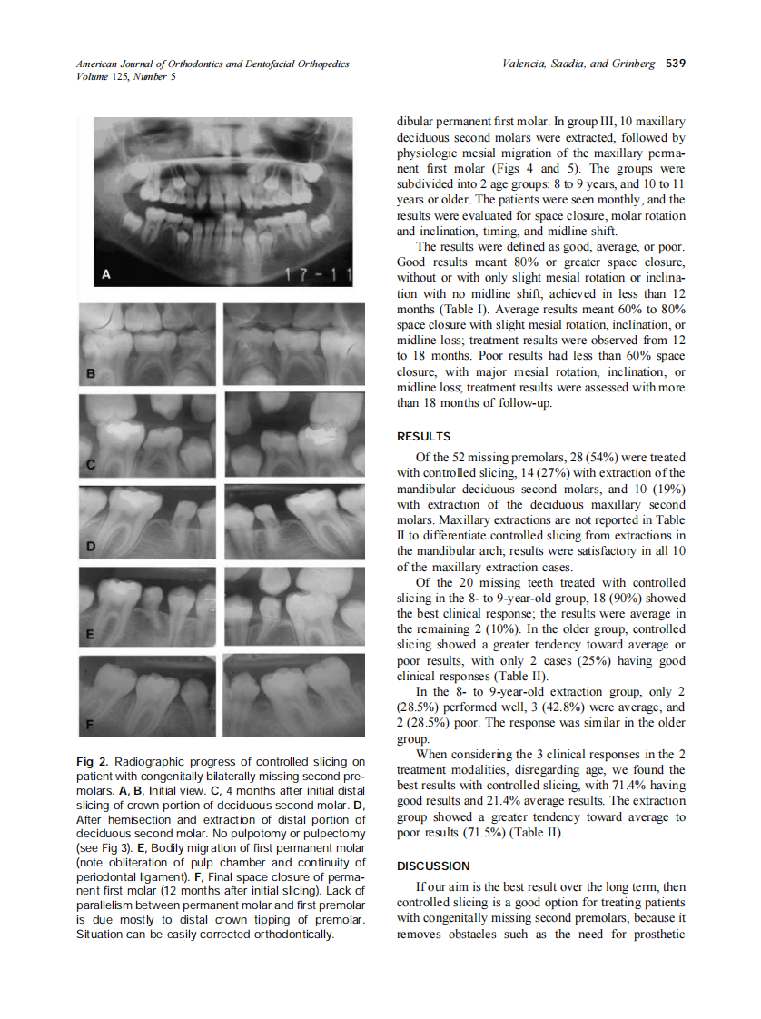 2004_125_5_537_543_Valencia.pdf 第3页