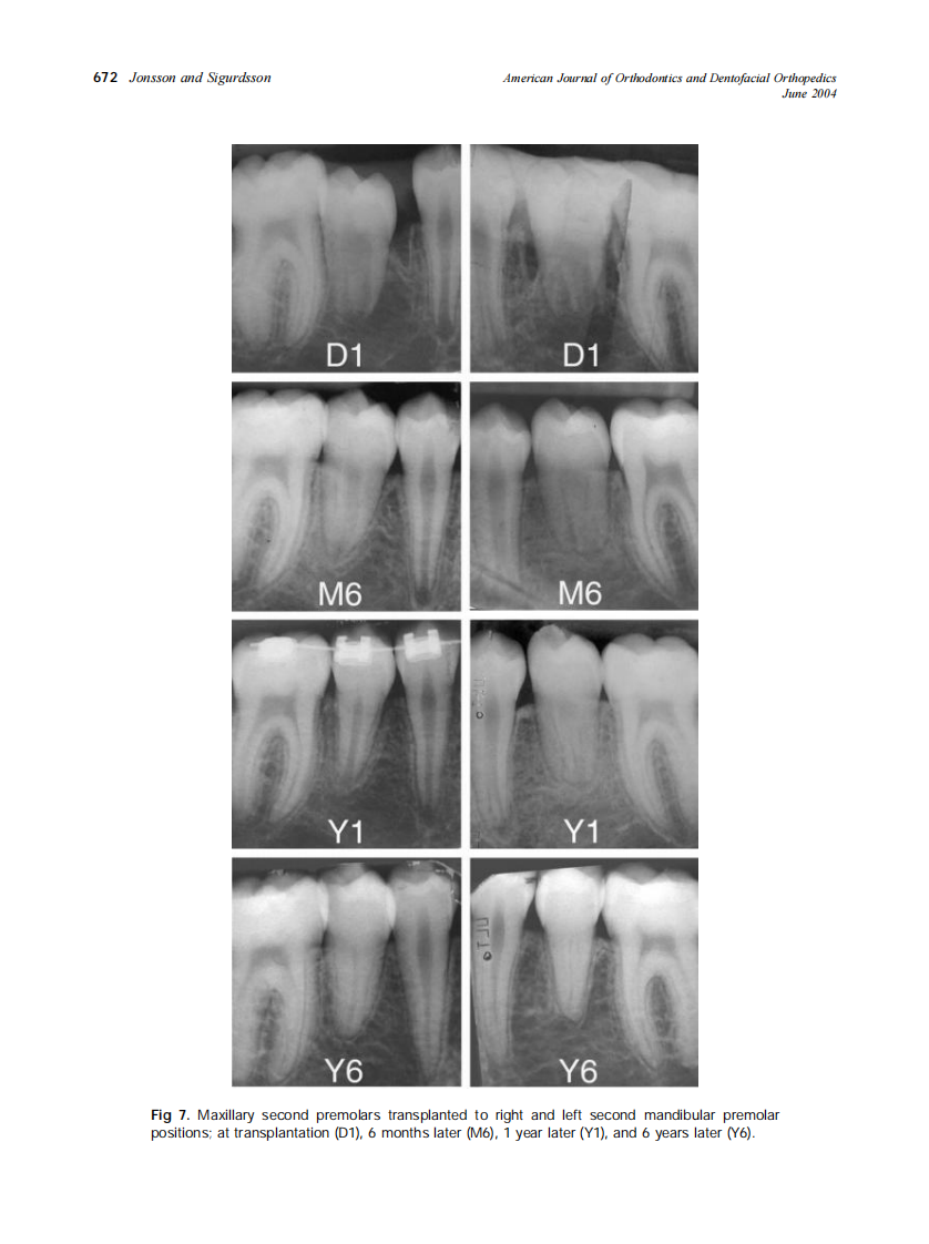 2004_125_6_668_675_Jonsson.pdf 第5页