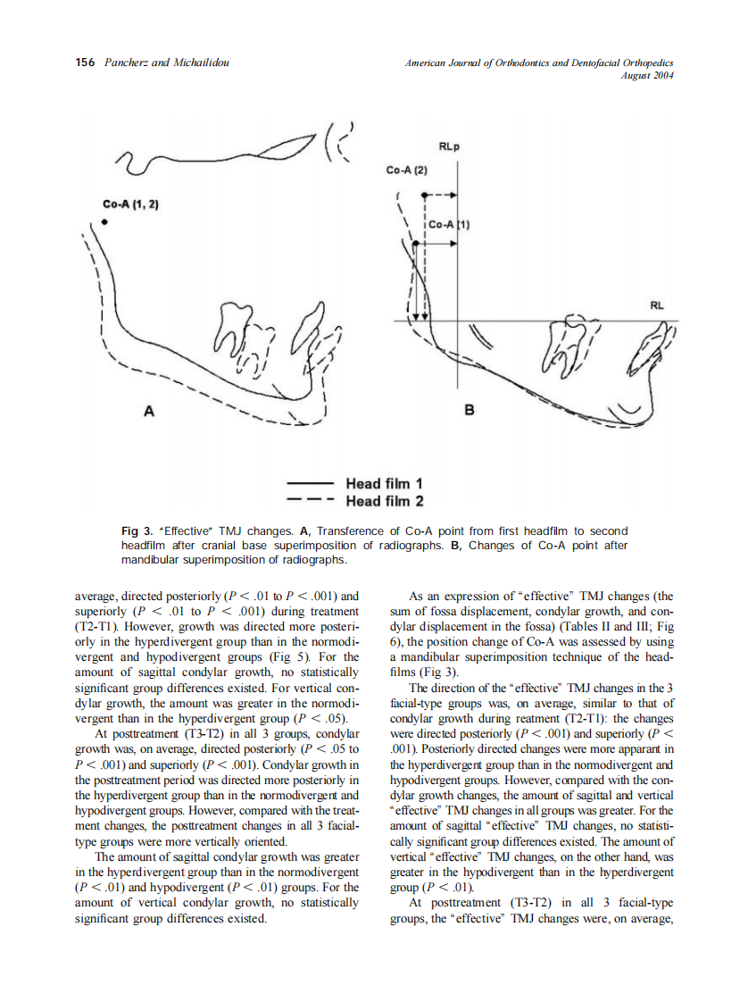 2004_126_2_153_161_Pancherz.pdf 第4页