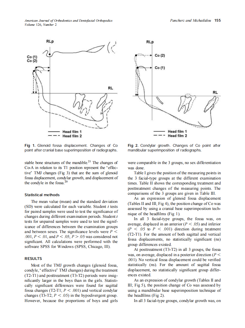 2004_126_2_153_161_Pancherz.pdf 第3页