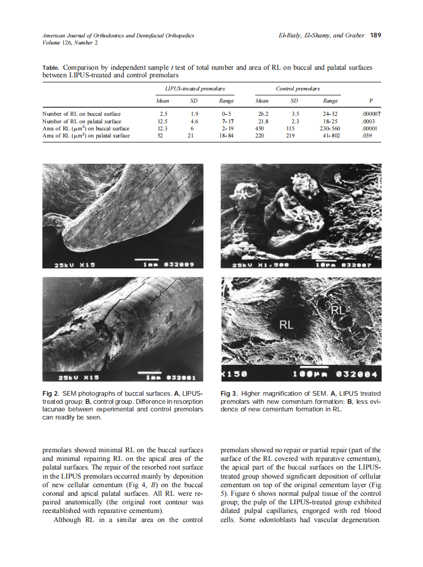 2004_126_2_186_193_El-Bialy.pdf 第4页